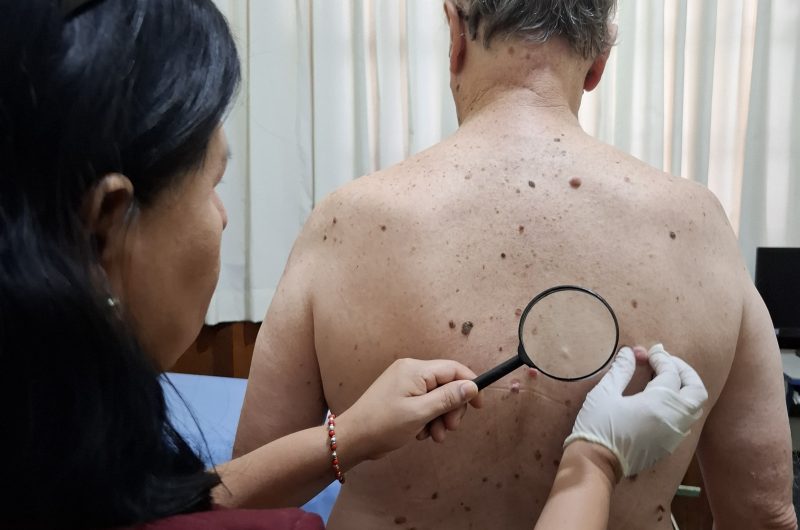 Liga Contra el Cáncer llevará prevención a la población de Piura